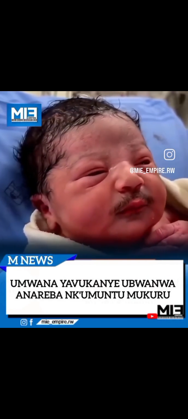 Umwana ugaragara nk’ufite ubwanwa akivuka yatangaje benshi ku mbuga nkoranyambaga